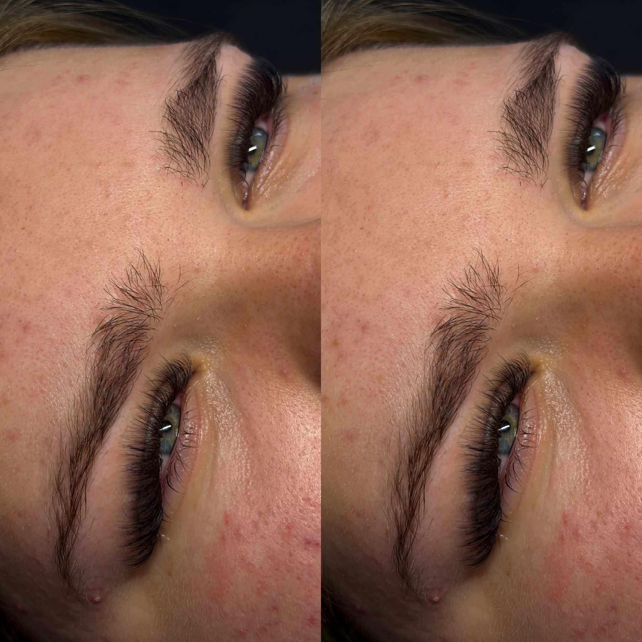 Brow treatments